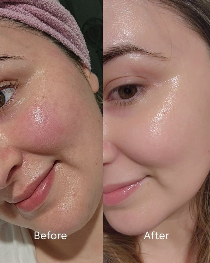 Sunscreen
